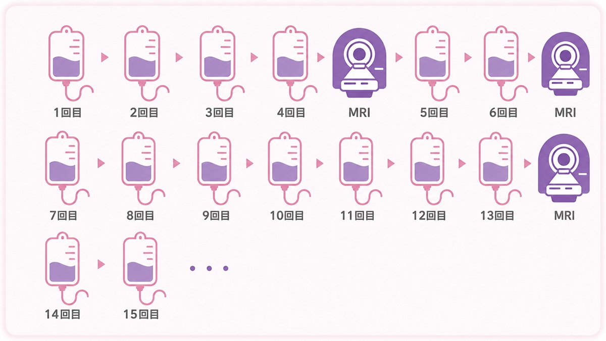 レケンビを初めて投与する前にはMRI検査が必要